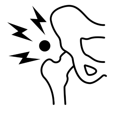 developmental hip dysplasia or ddh