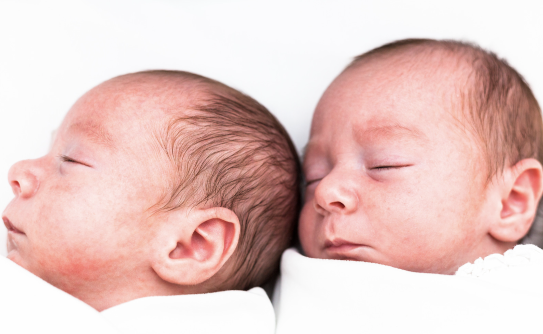 Twins with left torticollis in Scottsdale, AZ