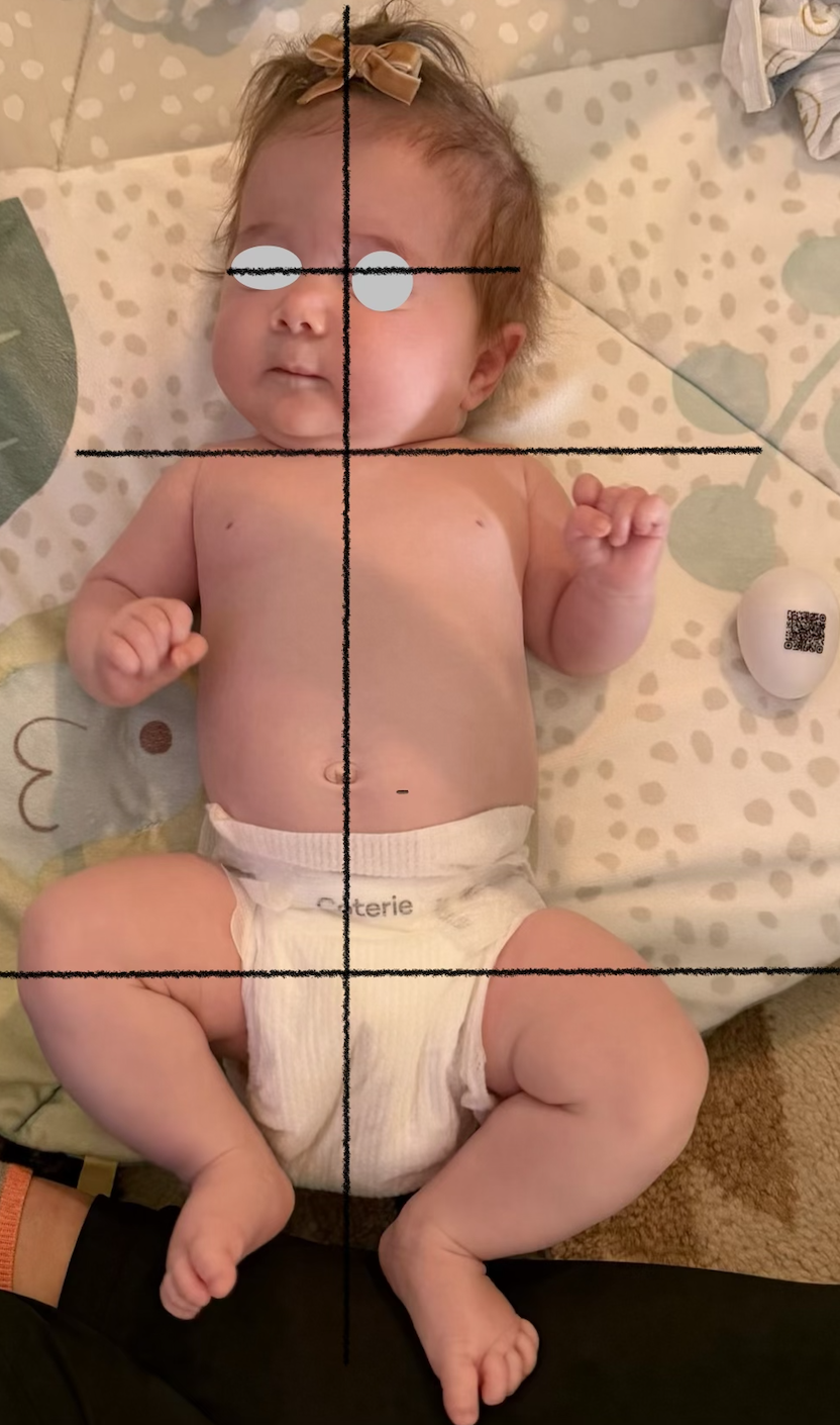 baby on their back with torticollis shown on their back with lines as reference points in Scottsdale, AZ