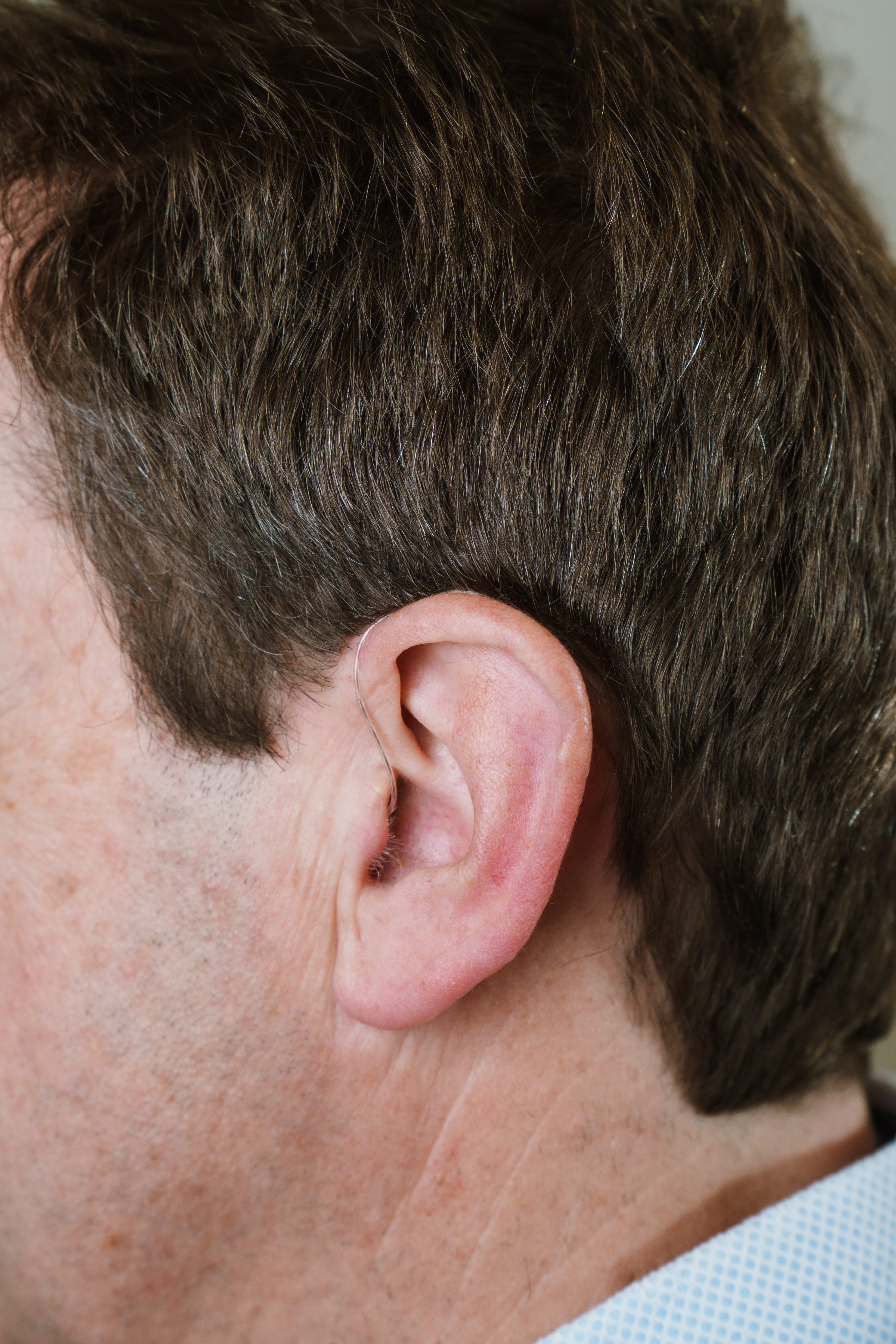 Hinter-dem-Ohr-Hörgeräte: Vielseitig und diskret