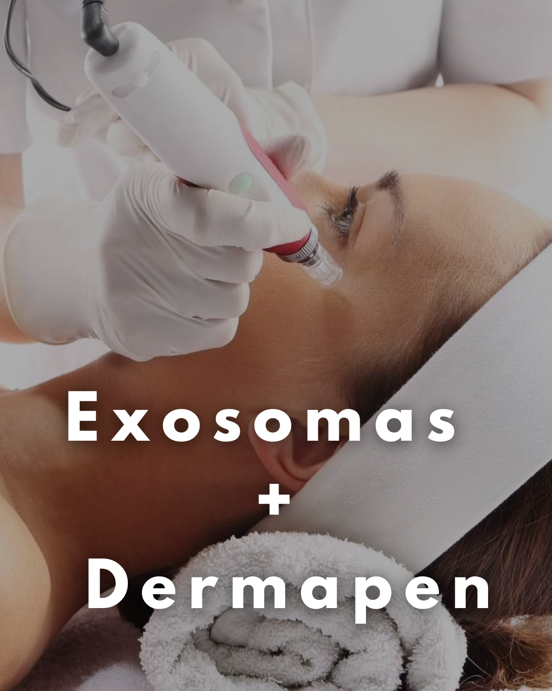 Exosomas