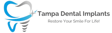 Tampa Dental Implants