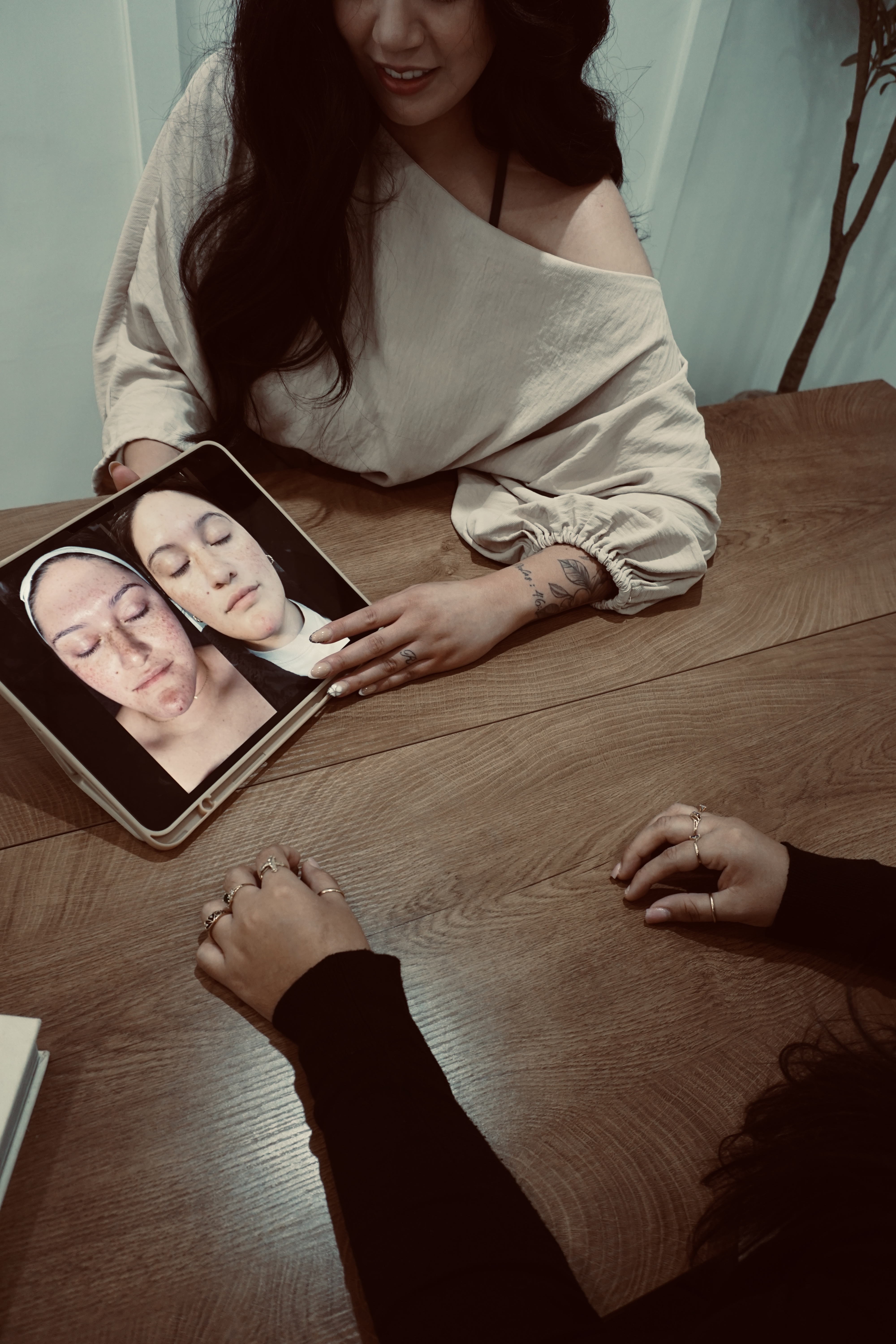 Bianca reviewing skin progress photos during a consultation