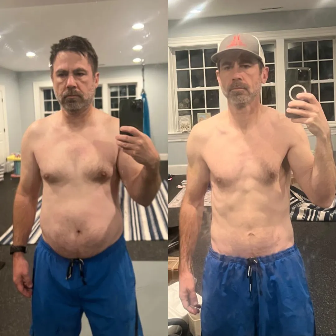 Brigham before and after