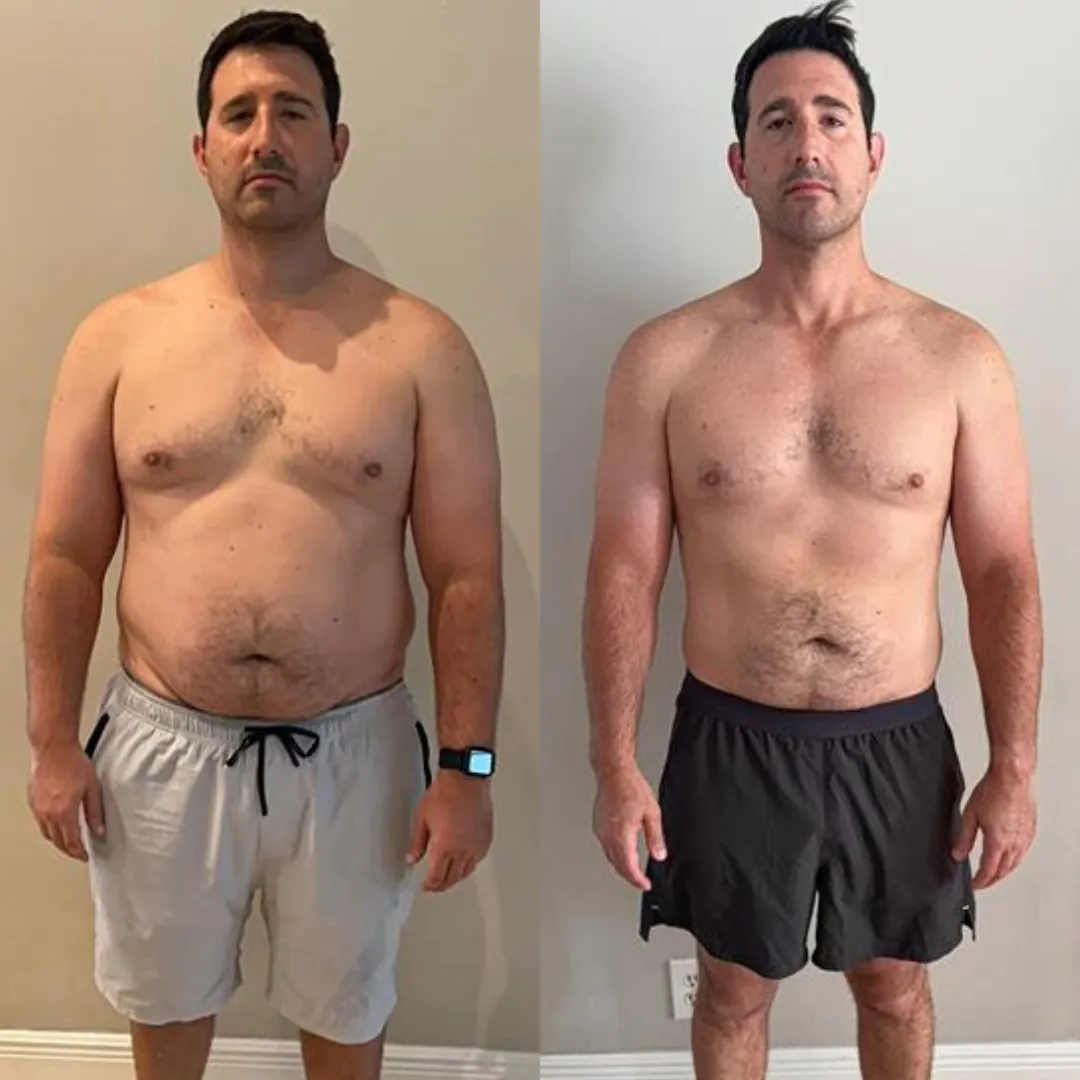 Brett before and after
