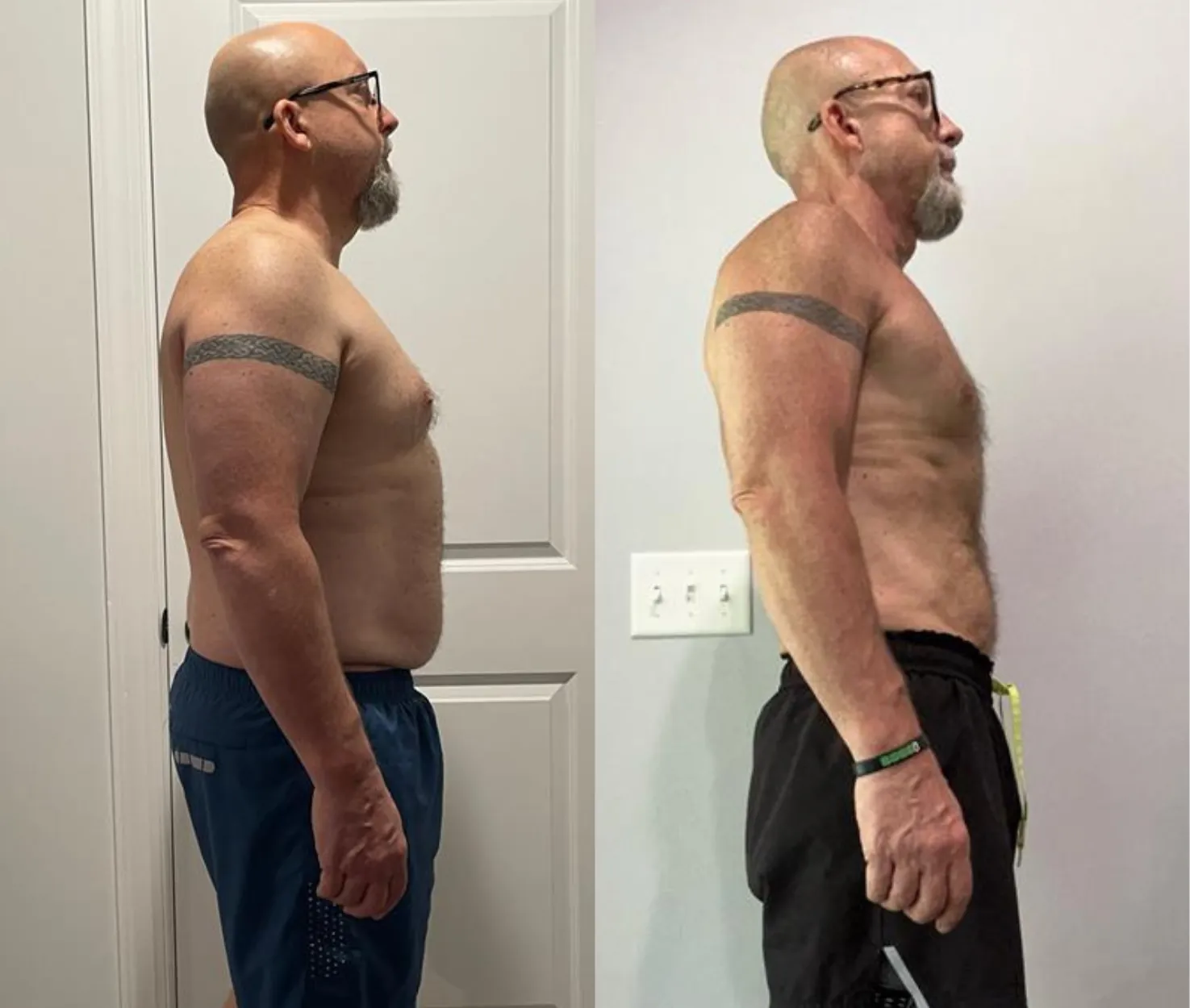 William before and after