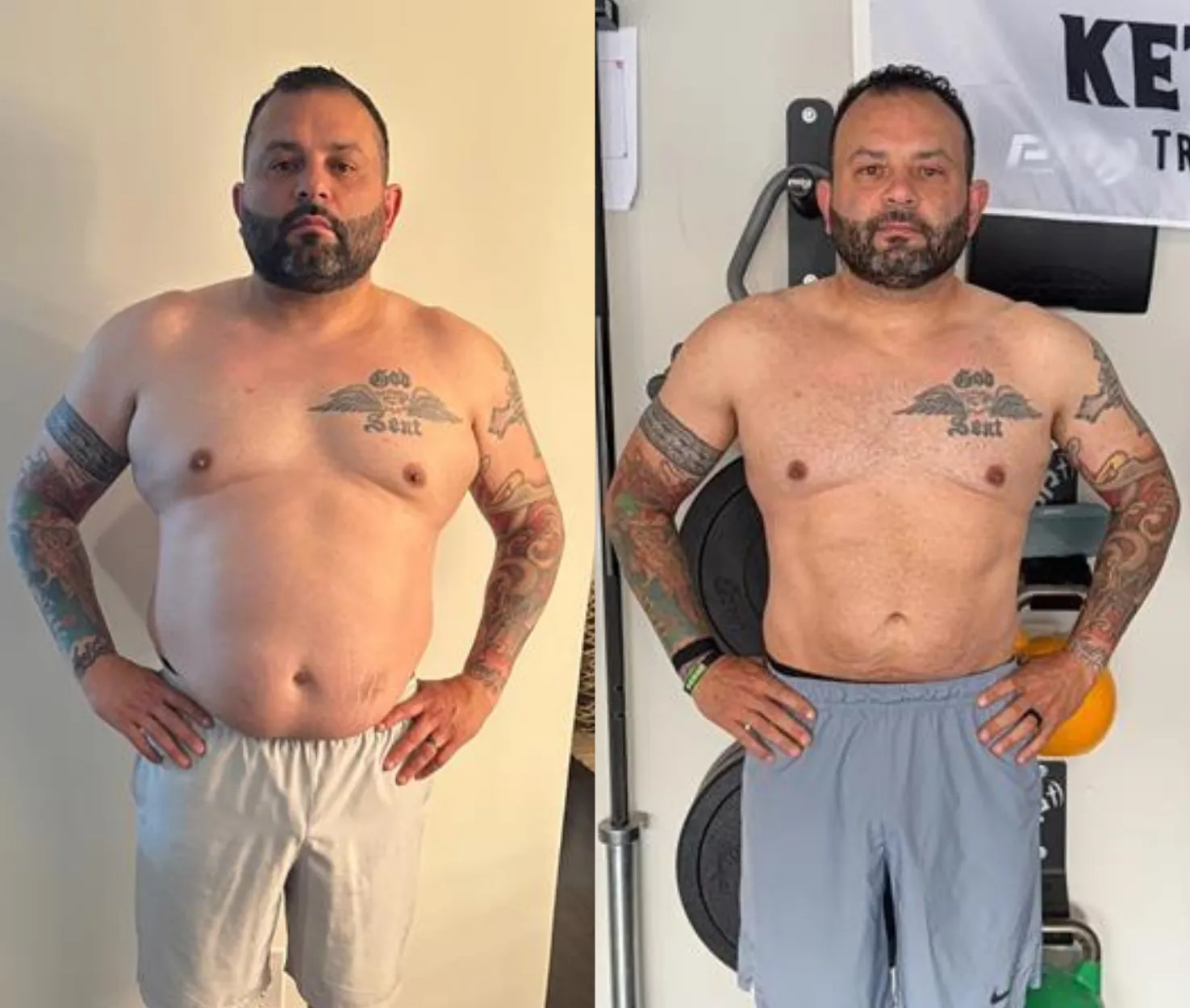 Nelson before and after