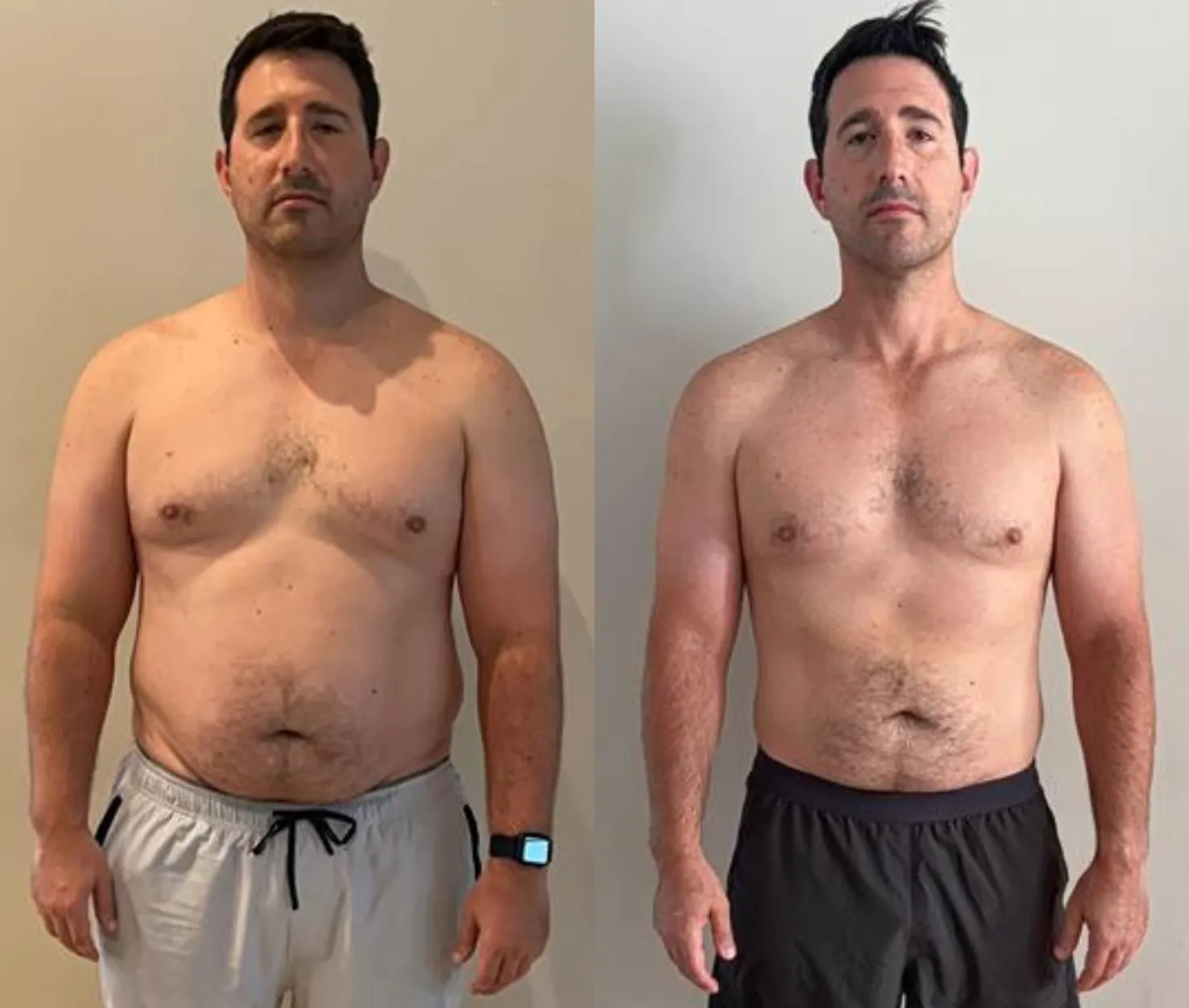 Brett before and after