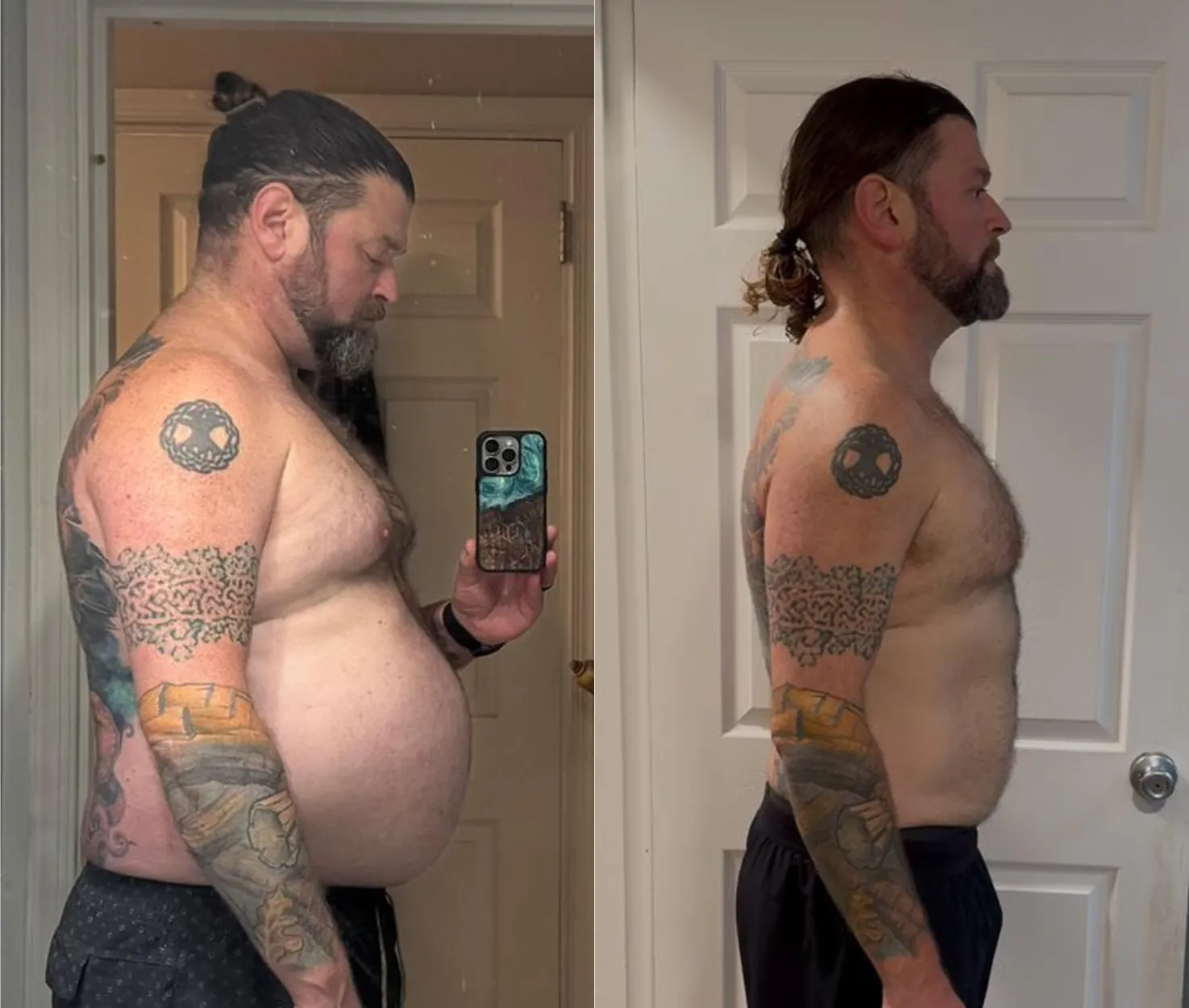 Adam before and after