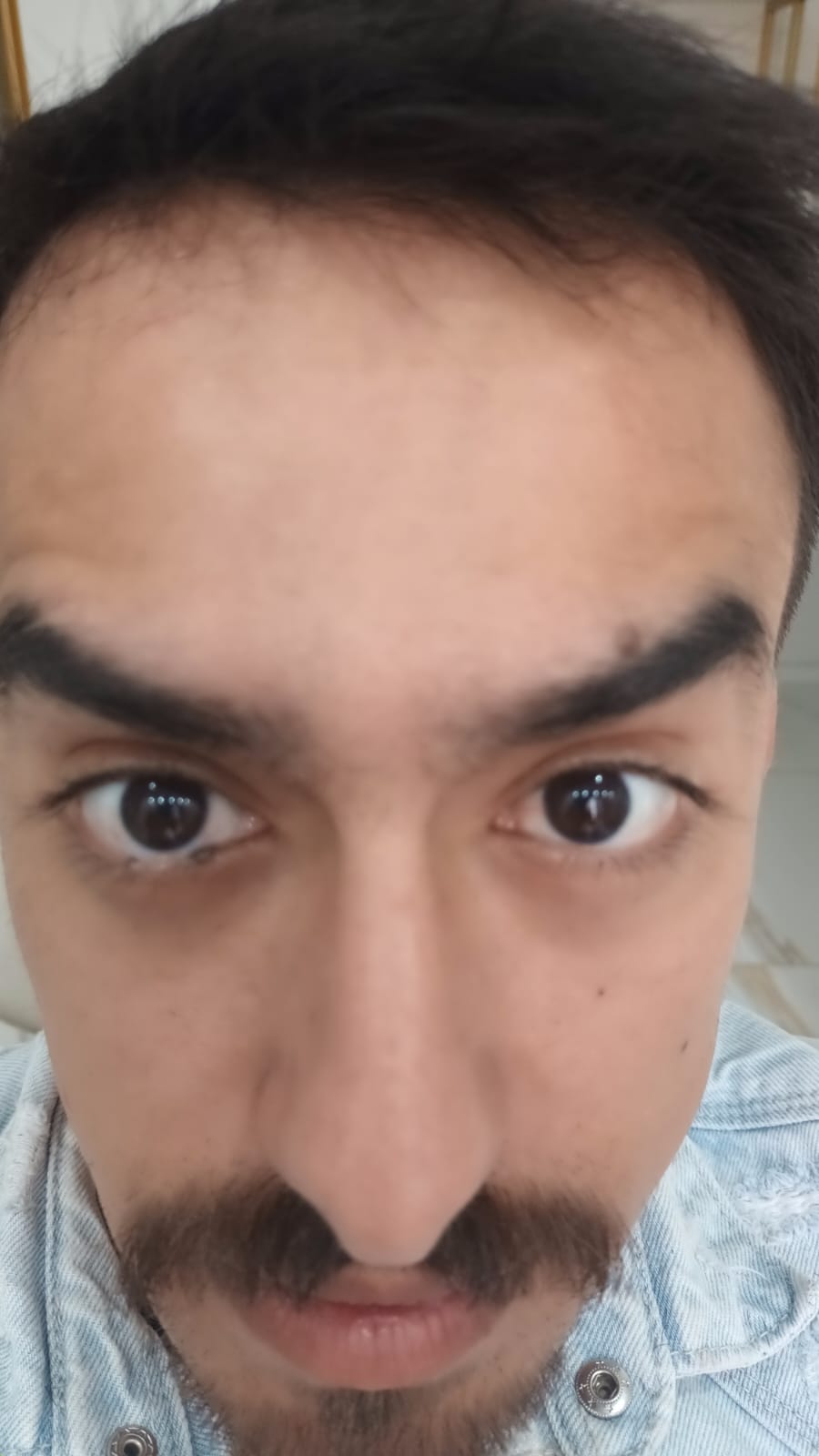 Depois do tratamento
