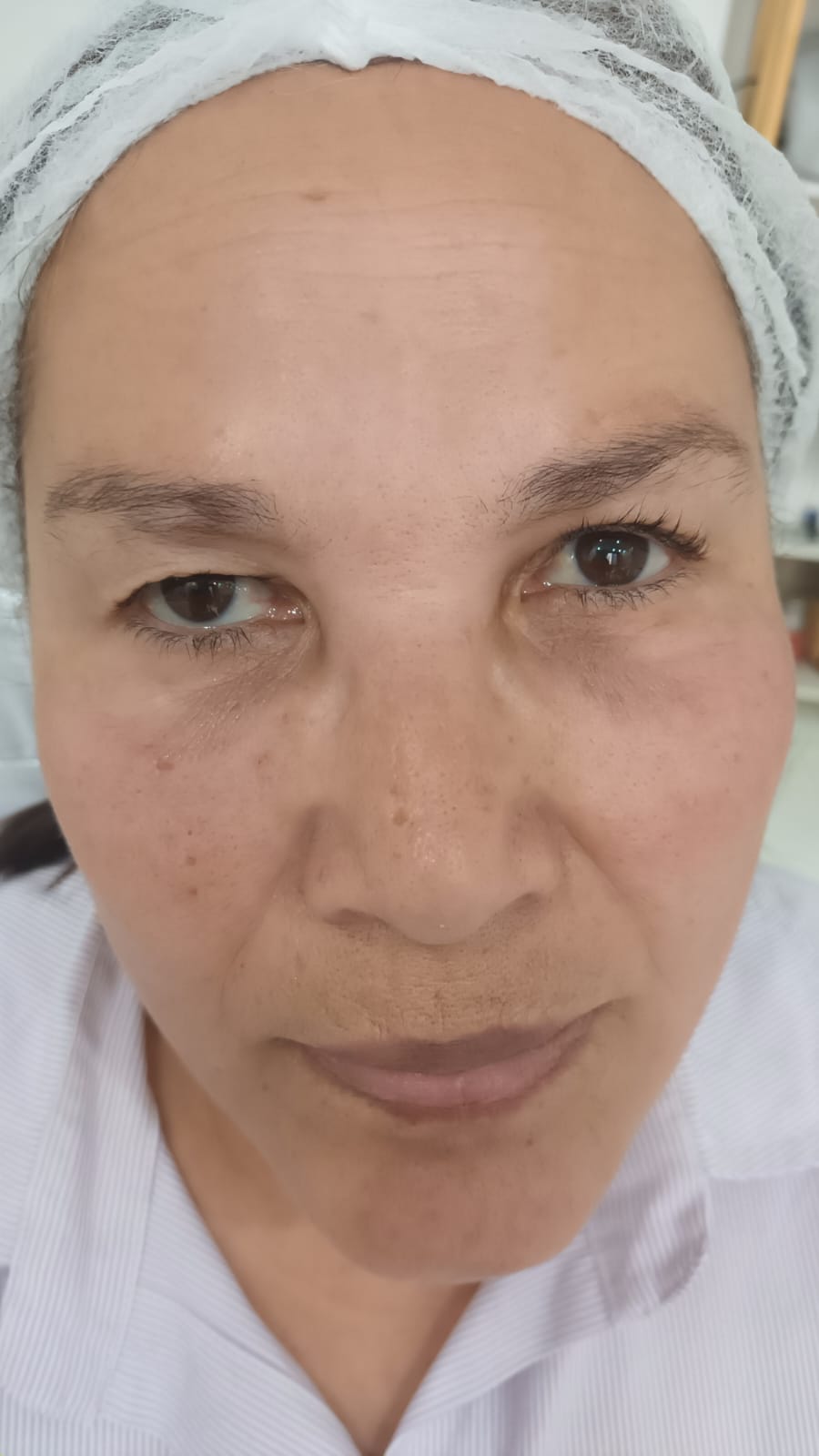 Depois do tratamento