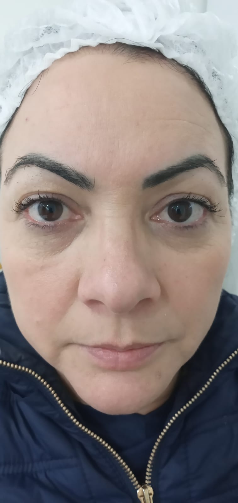 Depois do tratamento