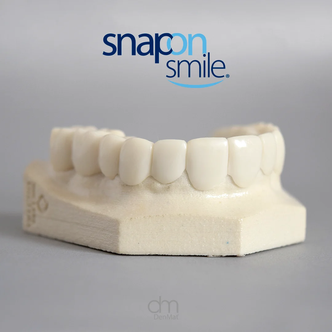 Sonrisa transformada 1