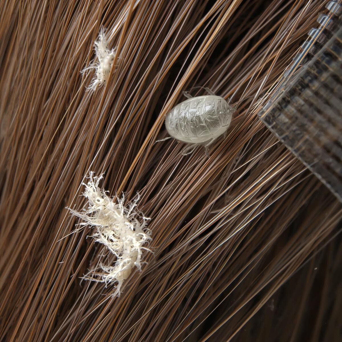 Head lice life cycle diagram showing eggs, nymph, and adult stages