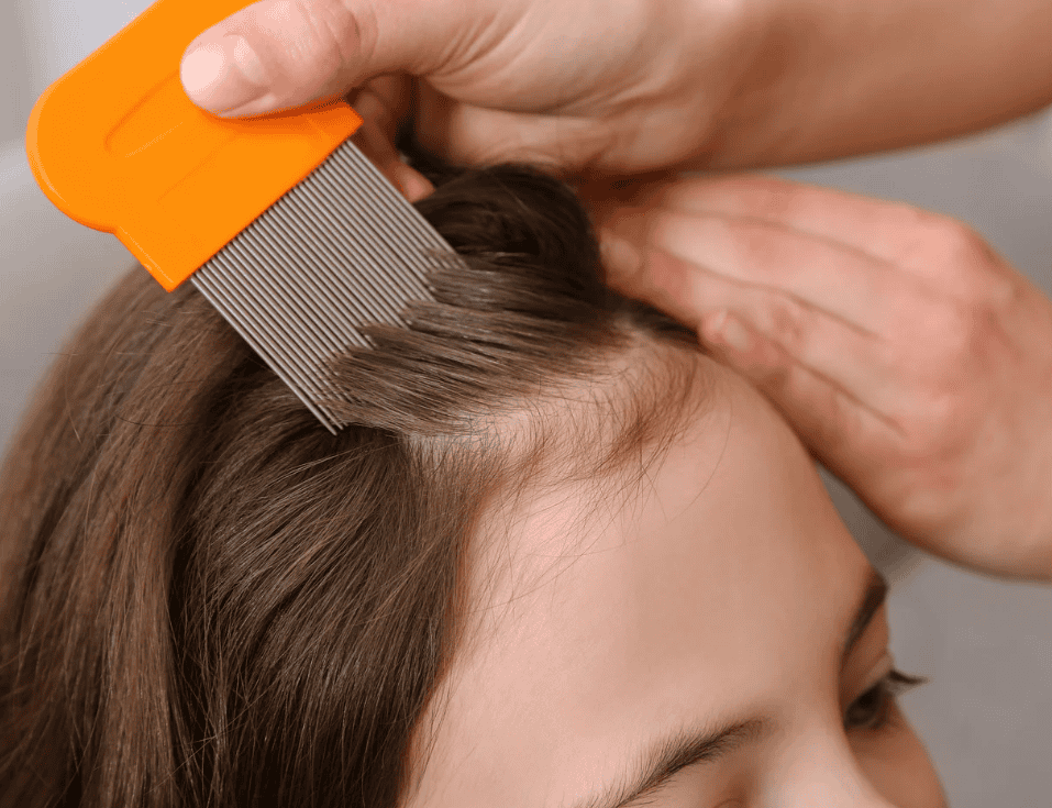 Going Beyond the Comb: Professional Lice Removal Services Going Beyond the Comb: Professional Lice Removal Services