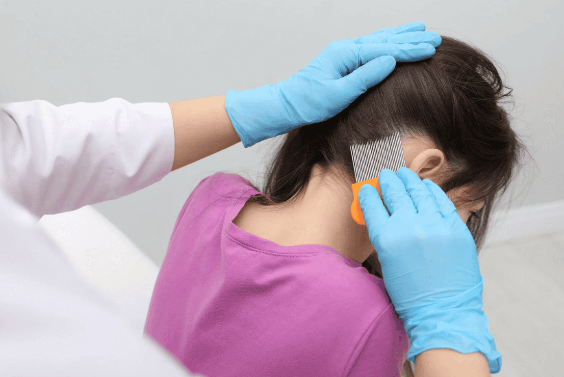 Selecting the Right Lice Removal Service for Your Needs Selecting the Right Lice Removal Service for Your Needs