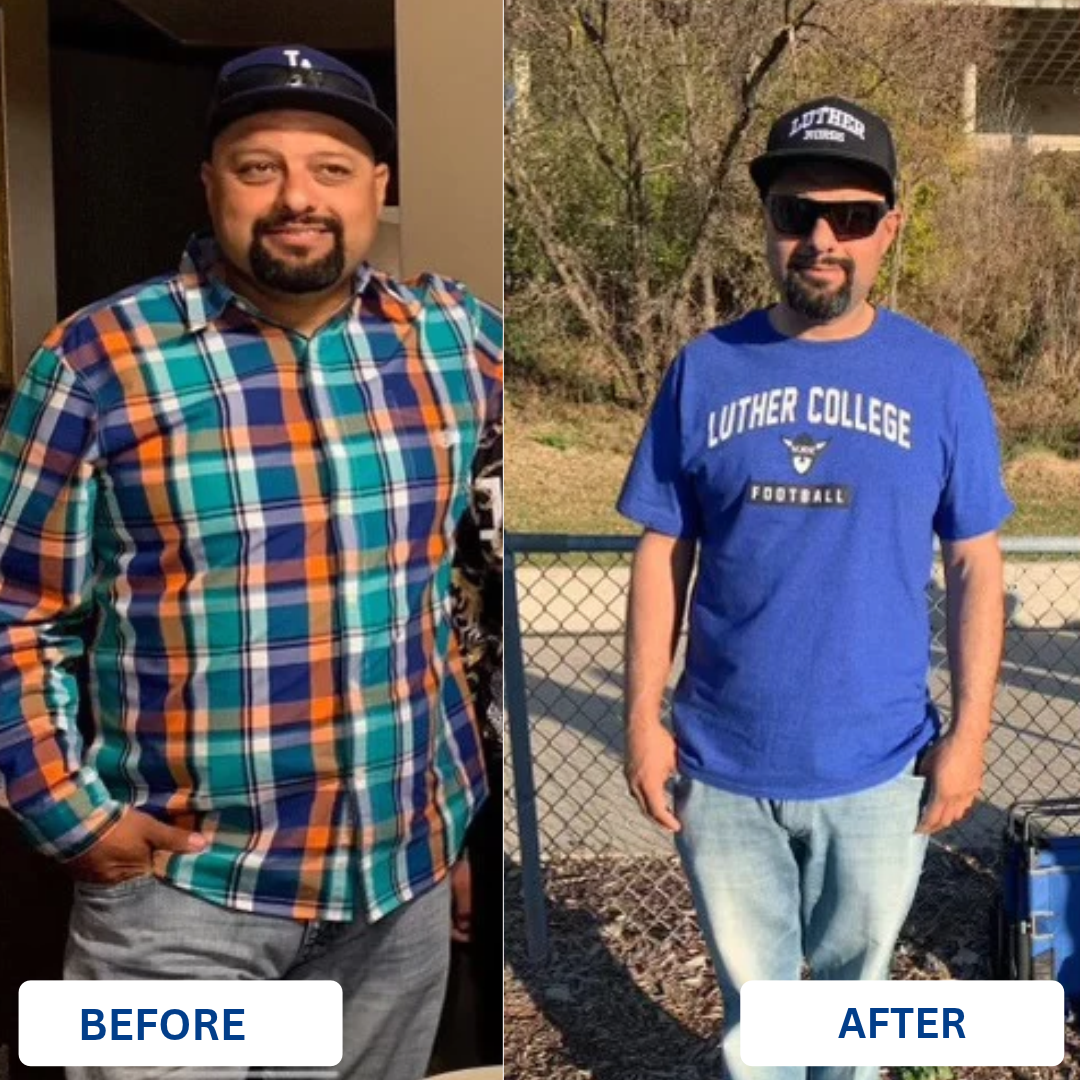Steve Espinoza — before and after