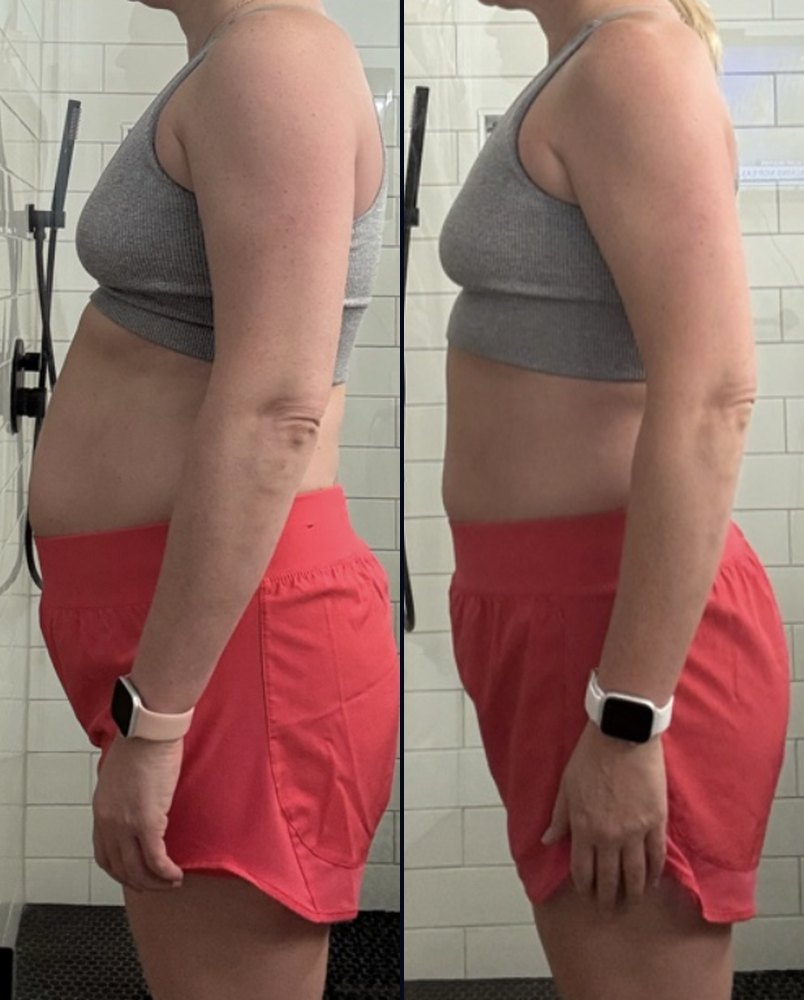 Before and after photos of Susan