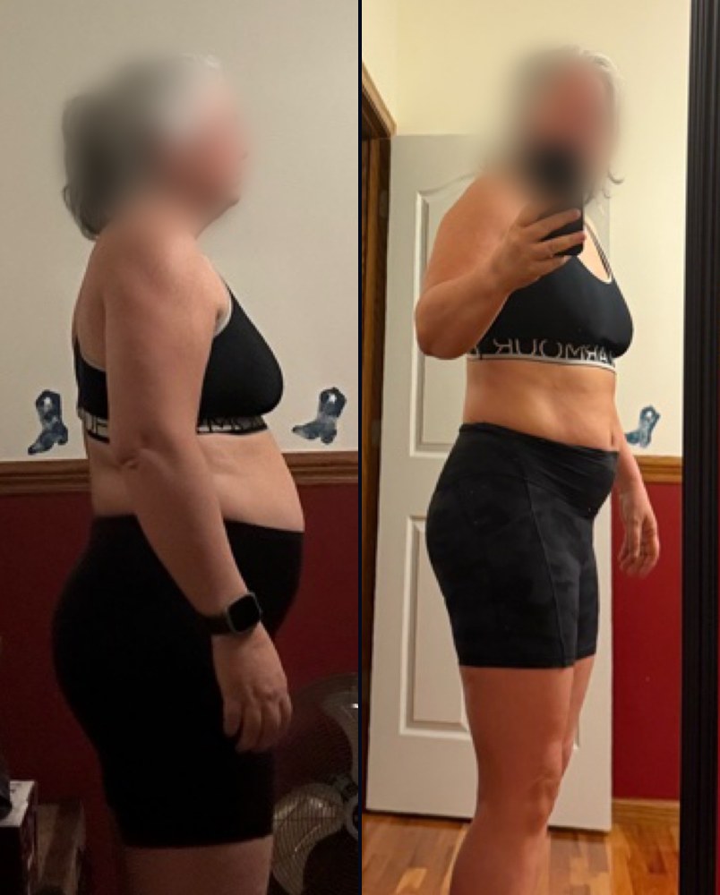 Before and after photos of Kat