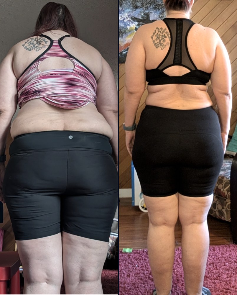 Before and after photos of Carla