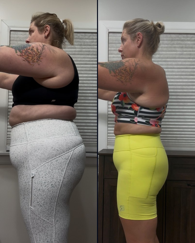 Before and after photos of Meghan