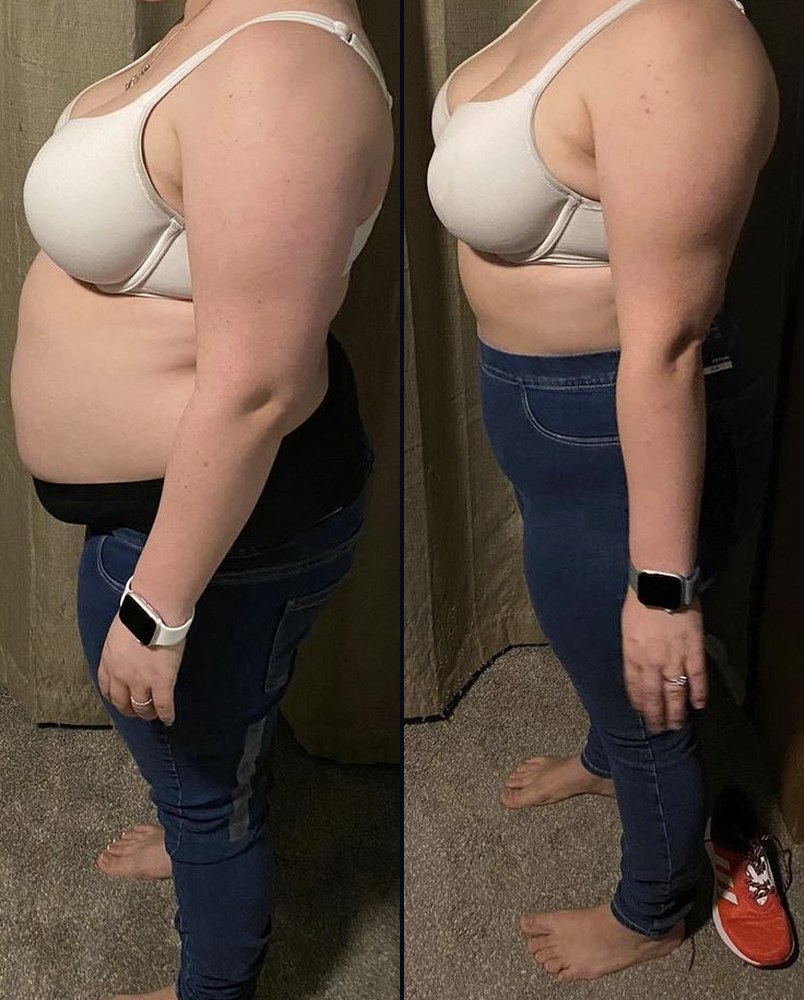 Before and after photos of Amber