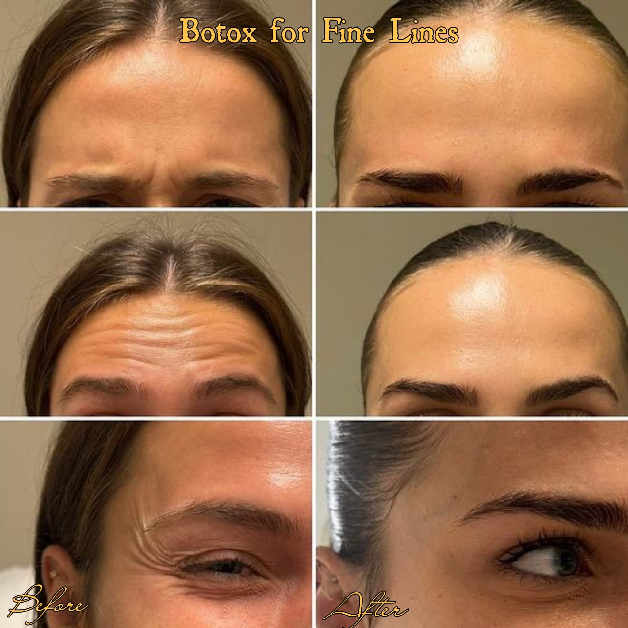 Before and after result, Farham Aesthetic Clinic