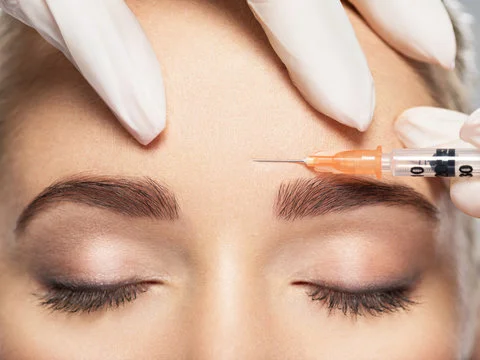 Anti-wrinkle Botox treatment