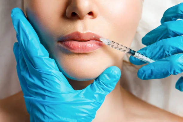 Lip filler treatment