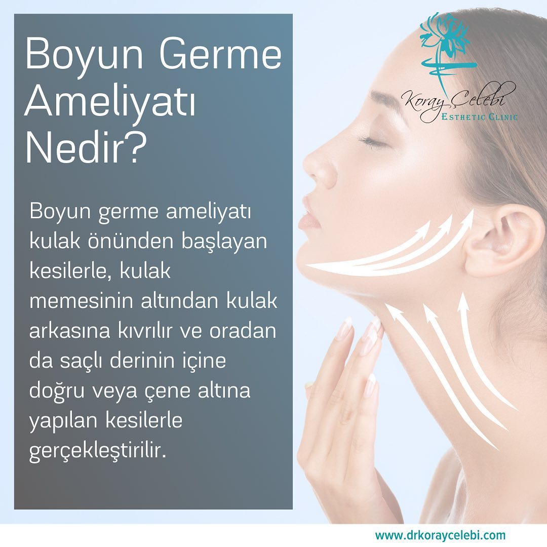 Boyun Germe Ameliyatı: Kulak çevresinden yapılan kesilerle germe işlemi