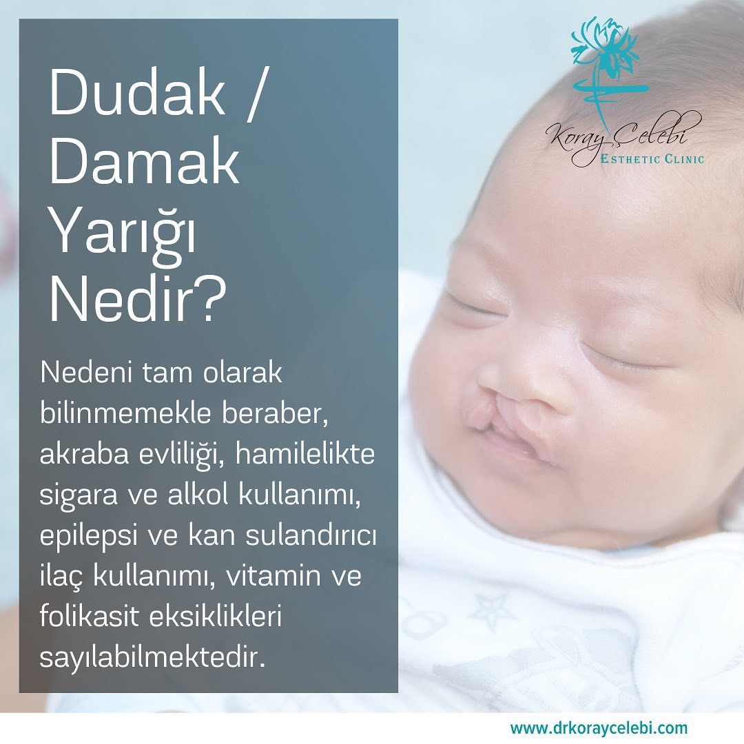 Dudak/Damak Yarığı: Nedenleri (sigara, alkol, vitamin eksikliği vb.)
