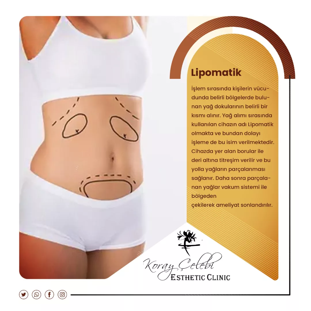 Vücut Şekillendirme (Liposuction) Öncesi ve Sonrası