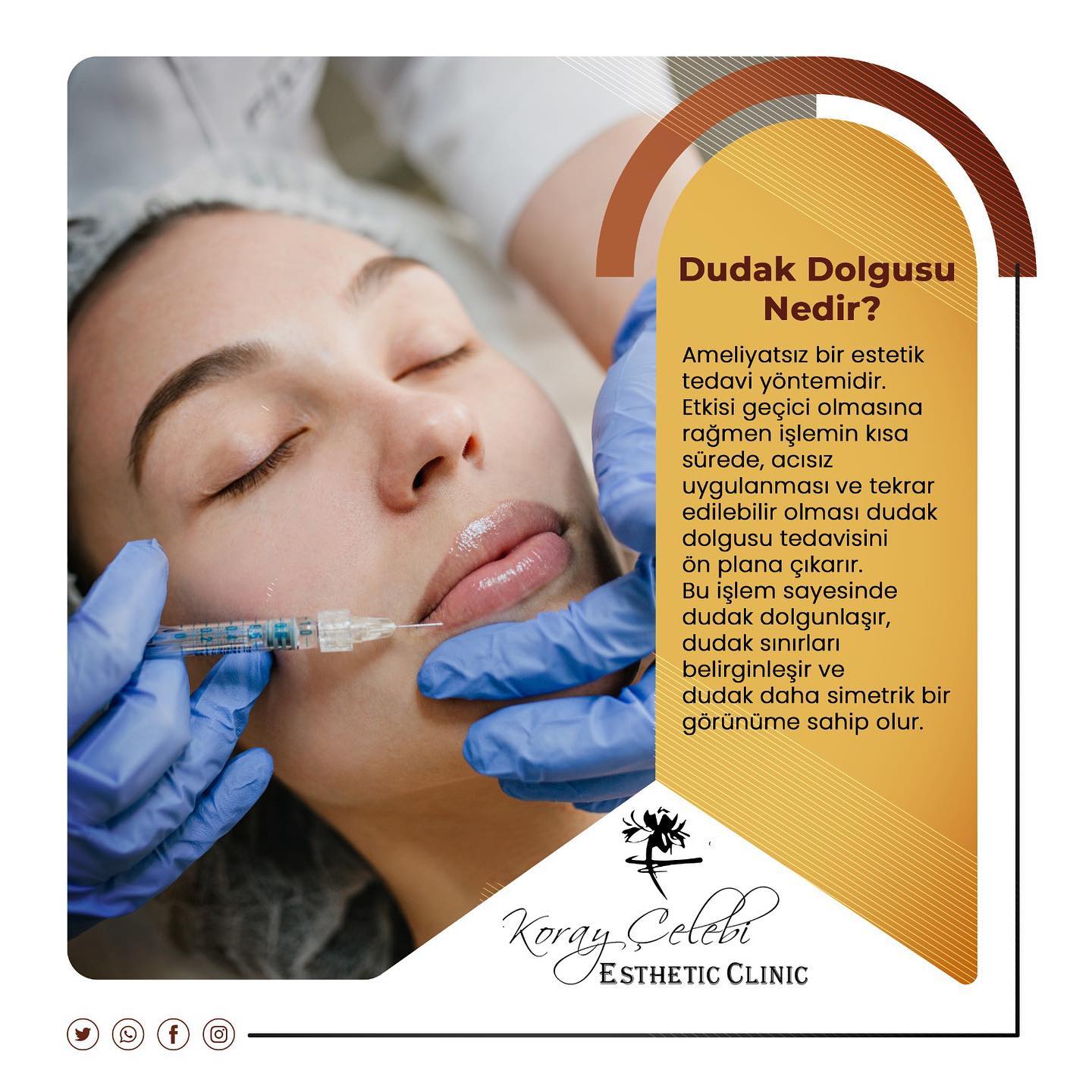 Dudak Dolgusu Öncesi ve Sonrası