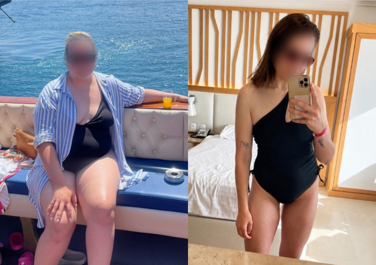 Transformarea Denisa înainte și după
