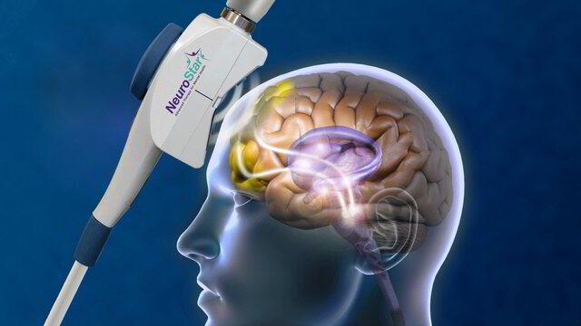 NeuroStar TMS therapy  | Medpsych Integrated 