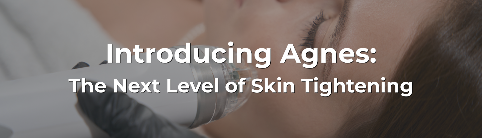 Introducing Agnes: The Next Level of Skin Tightening