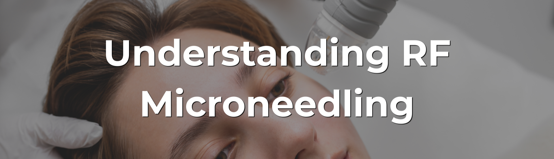 Understanding RF Microneedling