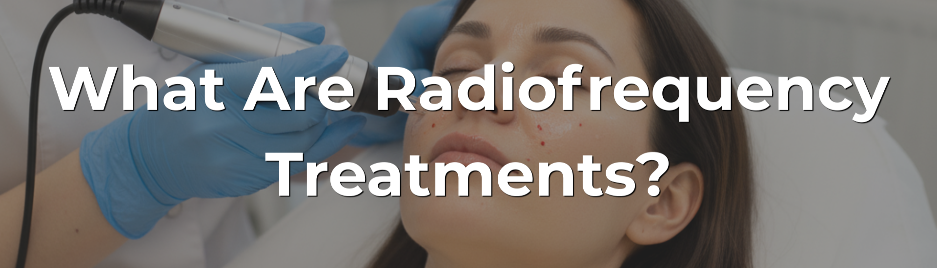 What Are Radiofrequency Treatments?