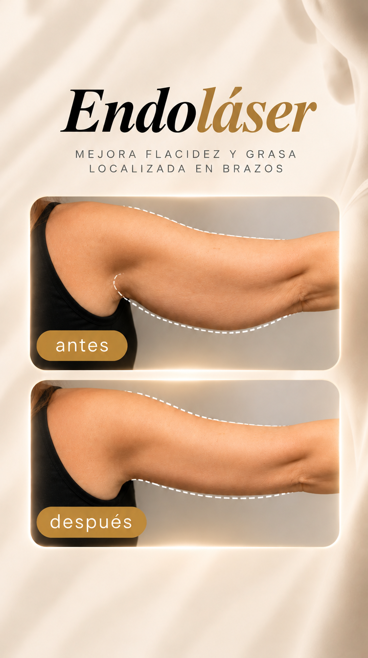 Caso clínico 2 Endoláser, antes y después