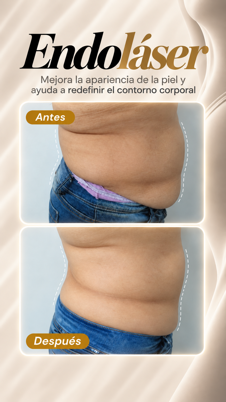 Caso clínico 6 Endoláser, antes y después