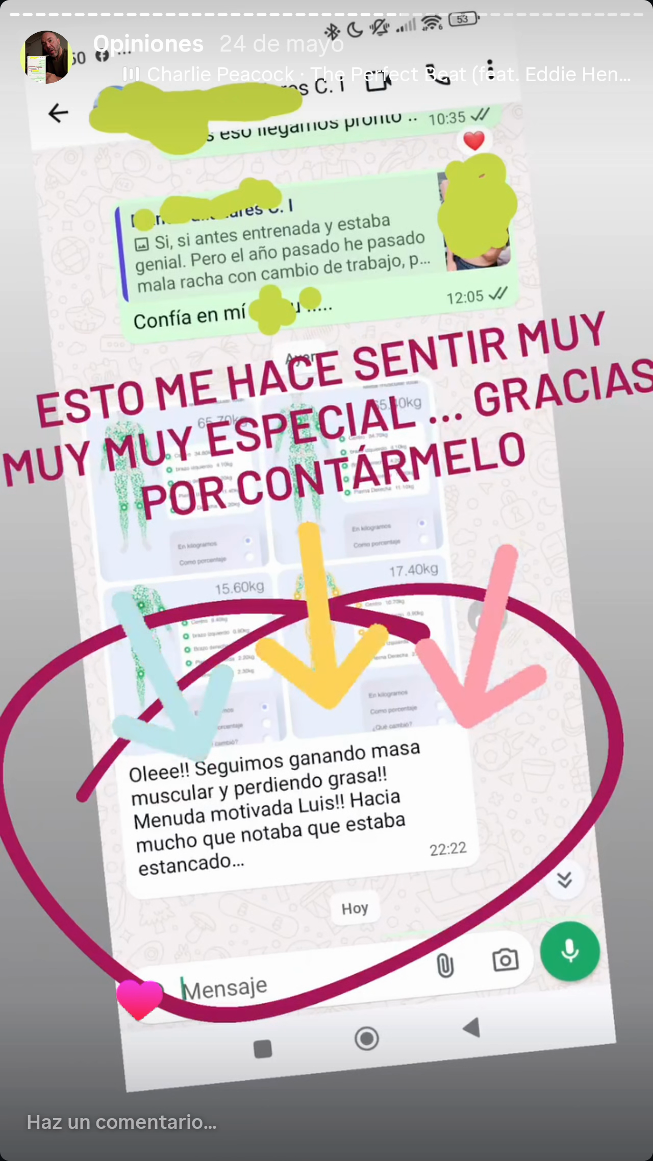 Opinión