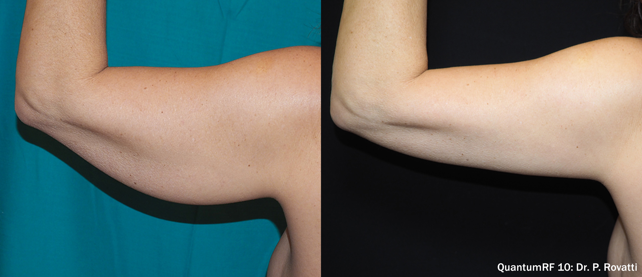 Before and after — patient 7