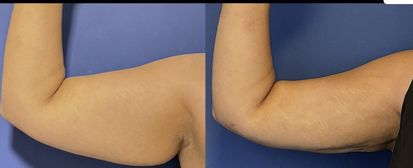 Before and after — patient 2