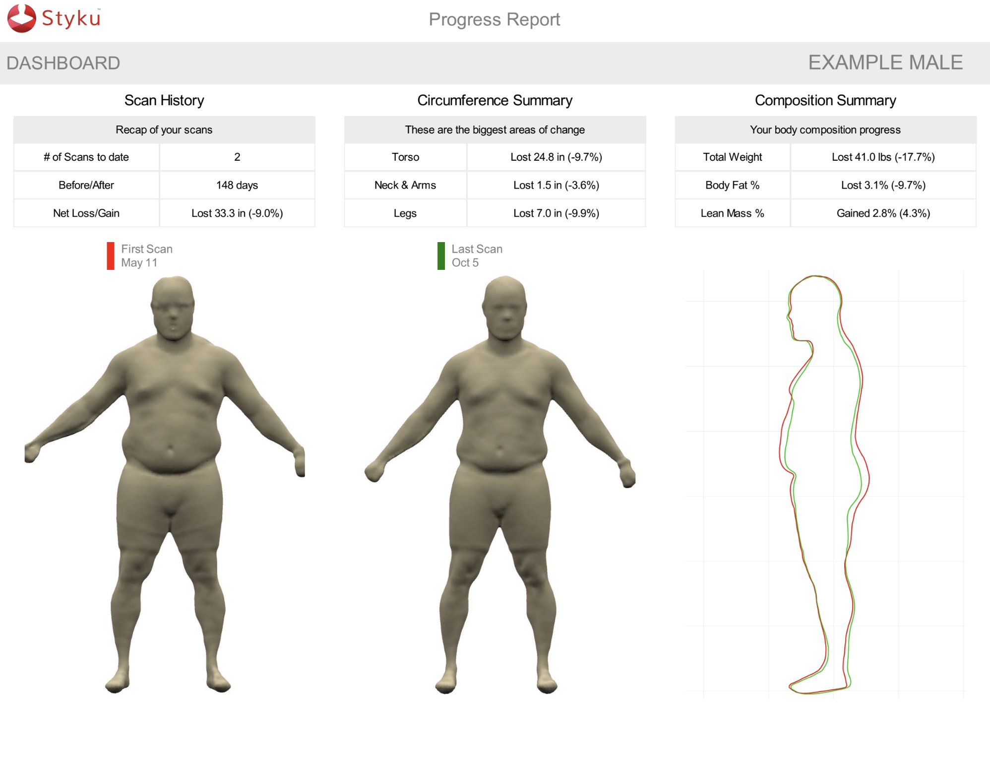 3D body scan before and after