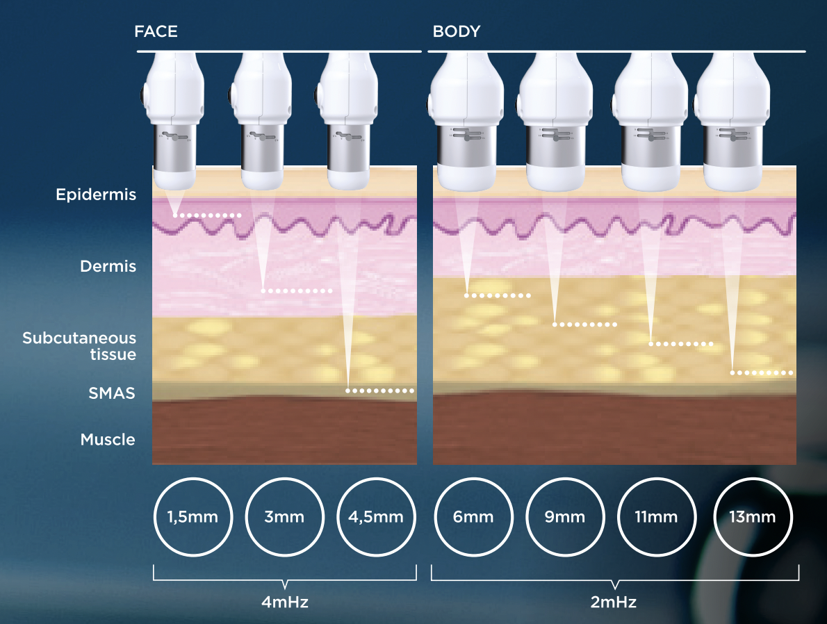 CFU Elife face and body focal-depth diagram