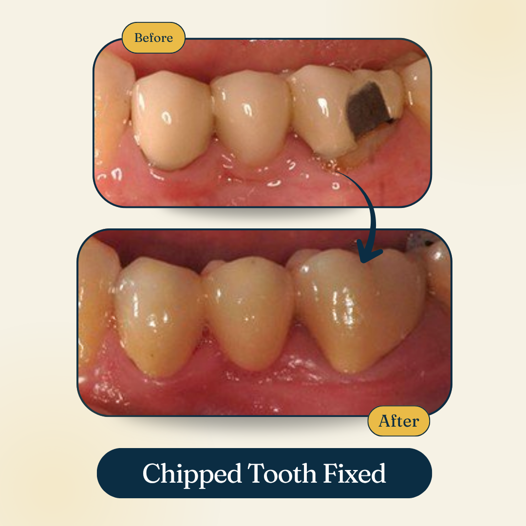 Patient smile result
