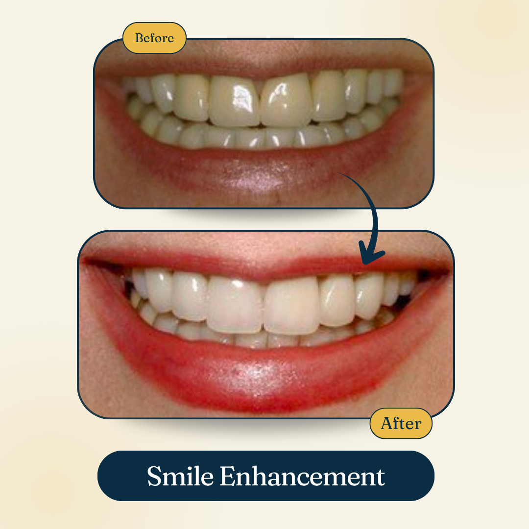 Patient smile result