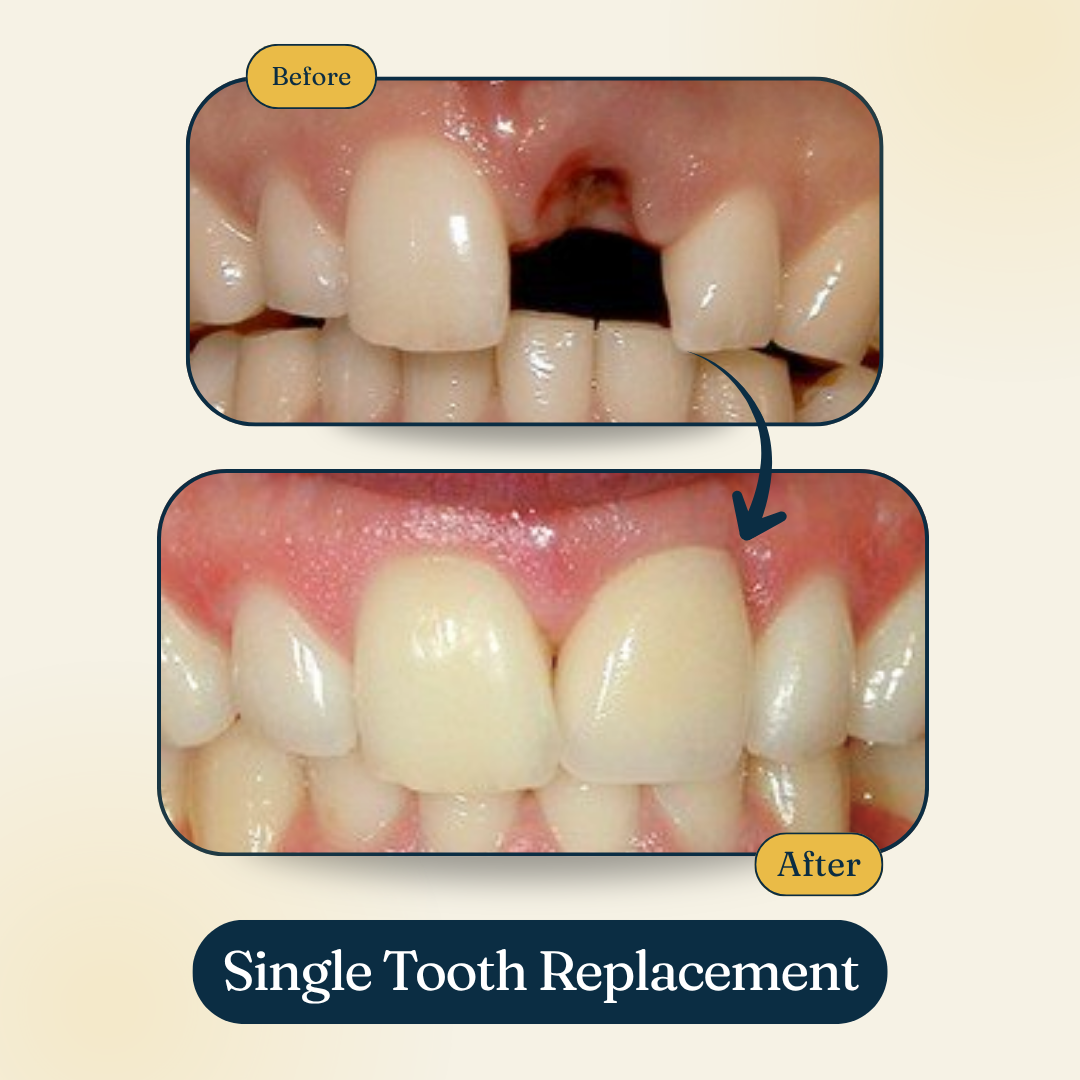 Patient smile result