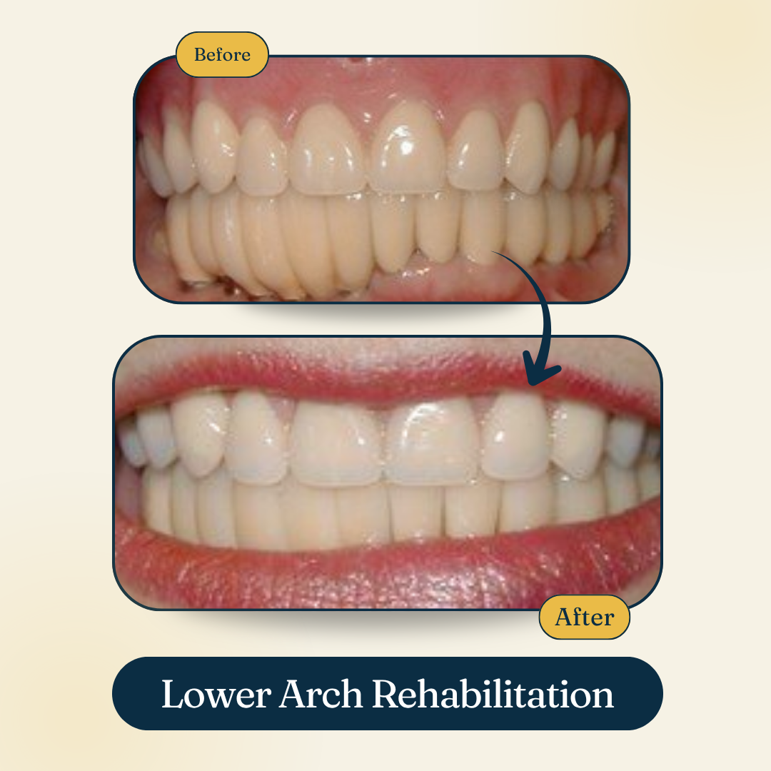 Patient smile result