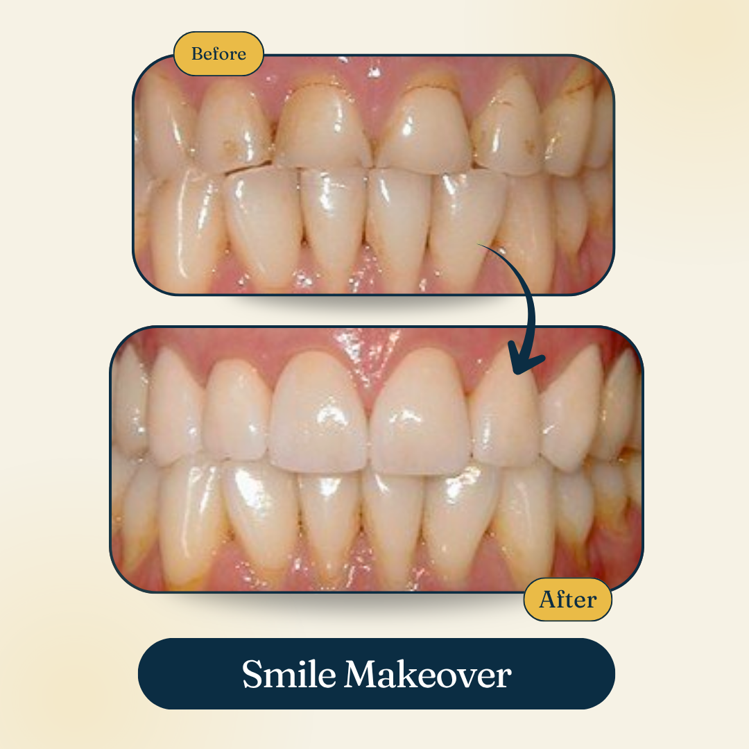 Patient smile result